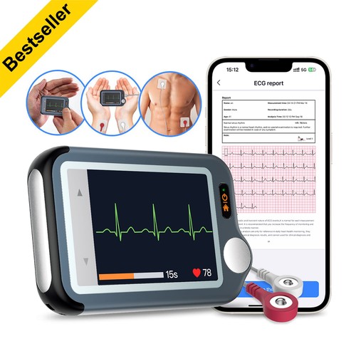 Checkmeex tragbares ekg gerät - checkmeex,