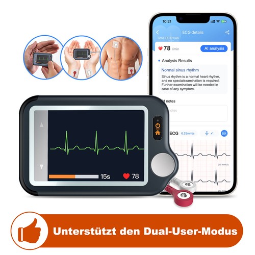 Checkmeex tragbares ekg gerät - tragbares, ekg-gerät
